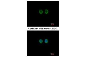 ICC/IF Image Immunofluorescence analysis of methanol-fixed A549, using RAGE, antibody at 1:100 dilution.