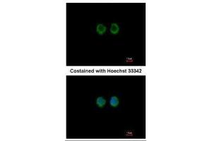 ICC/IF Image Immunofluorescence analysis of methanol-fixed A549, using RAGE, antibody at 1:100 dilution. (MOK anticorps)