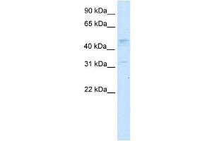 Western Blot showing TCFAP2C antibody used at a concentration of 1-2 ug/ml to detect its target protein. (TFAP2C anticorps  (N-Term))