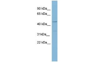 WB Suggested Anti-MATN1  Antibody Titration: 0.