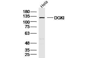 Hela lysates probed with DGKI Polyclonal Antibody, Unconjugated  at 1:300 dilution and 4˚C overnight incubation. (DGKI anticorps  (AA 101-200))