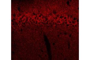 Indirect immunostaining of a rat hippocampus section fixed with 4 % PFA and 15 % picric acid (dilution 1 : 500).