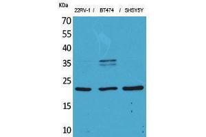 Western Blotting (WB) image for anti-Fibroblast Growth Factor 12 (FGF12) (Internal Region) antibody (ABIN3187704) (FGF12 anticorps  (Internal Region))