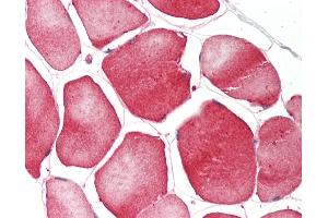 Human Skeletal Muscle: Formalin-Fixed, Paraffin-Embedded (FFPE).