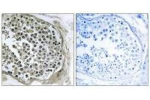 Immunohistochemistry analysis of paraffin-embedded human tesophagusis tissue using GIDRP88 antibody. (GIDRP88 anticorps)