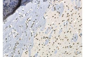 ABIN6261763 and ABIN6266541 at 1/100 staining Mouse brain tissue by IHC-P. (FLI1 anticorps  (Internal Region))