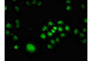 Immunofluorescence staining of Hela cells with ABIN7164043 at 1:166, counter-stained with DAPI.