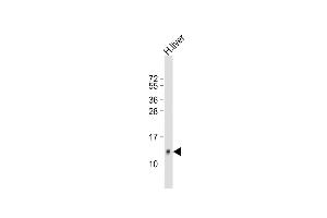 Anti-HP Antibody (Center) at 1:500 dilution + human liver lysate Lysates/proteins at 20 μg per lane. (Hepcidin anticorps  (AA 17-46))