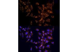 Immunofluorescence analysis of C6 cells using RPL10A Rabbit pAb (ABIN6129099, ABIN6147103, ABIN6147104 and ABIN6221624) at dilution of 1:100 (40x lens).