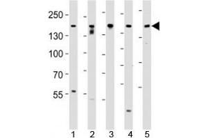 Western blot analysis of lysate from SH-SY5Y, MCF-7, PC3, LNCaP, HeLa, cell line (left to right) using Tuberin antibody at 1:1000 for each lane. (Tuberin anticorps  (AA 1776-1805))