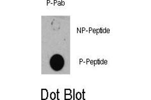 Image no. 1 for anti-Tuberous Sclerosis 1 (TSC1) (pSer505) antibody (ABIN358402) (TSC1 anticorps  (pSer505))
