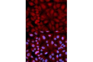 Immunofluorescence (IF) image for anti-Synuclein, gamma (Breast Cancer-Specific Protein 1) (SNCG) antibody (ABIN1874888) (SNCG anticorps)