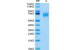 Cynomolgus IL-1 Rrp2/IL-1 R6 on Tris-Bis PAGE under reduced condition.