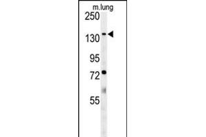 ATP11C Antibody (Center) (ABIN651638 and ABIN2840341) western blot analysis in mouse lung tissue lysates (35 μg/lane). (ATP11C anticorps  (AA 589-616))