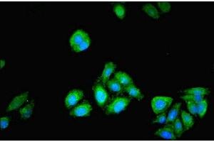 Immunofluorescent analysis of HepG2 cells using ABIN7163274 at dilution of 1:100 and Alexa Fluor 488-congugated AffiniPure Goat Anti-Rabbit IgG(H+L)
