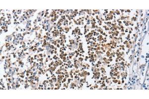Immunohistochemistry of paraffin-embedded Human tonsil using MCM6 Polyclonal Antibody at dilution of 1:45