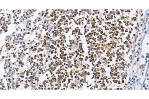 Immunohistochemistry of paraffin-embedded Human tonsil using MCM6 Polyclonal Antibody at dilution of 1:45 (MCM6 anticorps)