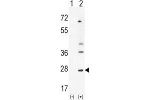 Western Blotting (WB) image for anti-Leukemia Inhibitory Factor (LIF) antibody (ABIN3002910) (LIF anticorps)