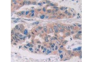 IHC-P analysis of Human Tissue, with DAB staining. (GZMM anticorps  (AA 26-257))