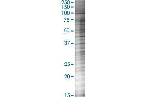 IL18RAP transfected lysate. (IL18RAP 293T Cell Transient Overexpression Lysate(Denatured))