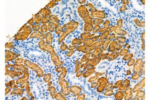 ABIN6257932 and ABIN6275132 at 1/100 staining Rat kidney tissue by IHC-P. (ALDOB anticorps  (C-Term))
