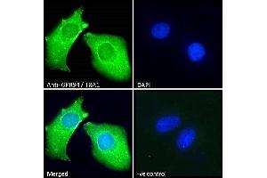 ABIN185655 Immunofluorescence analysis of paraformaldehyde fixed HeLa cells, permeabilized with 0.