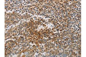 The image on the left is immunohistochemistry of paraffin-embedded Human tonsil tissue using ABIN7190267(CKMT1A/CKMT1B Antibody) at dilution 1/80, on the right is treated with synthetic peptide. (CKMT1A anticorps)