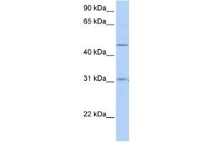 WB Suggested Anti-SLC39A11 Antibody Titration:  0. (SLC39A11 anticorps  (Middle Region))