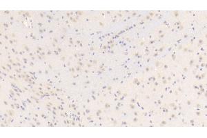 Detection of BGN in Mouse Cerebellum Tissue using Polyclonal Antibody to Biglycan (BGN)