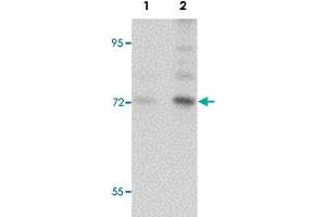 Western blot analysis of BALB/3T3 cells with ARHGAP18 polyclonal antibody  at (Lane 1) 1 and (Lane 2) 2 ug/mL dilution.