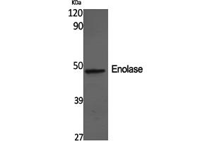 Western Blotting (WB) image for anti-Enolase 2 (Gamma, Neuronal) (ENO2) antibody (ABIN5960961) (ENO2/NSE anticorps)