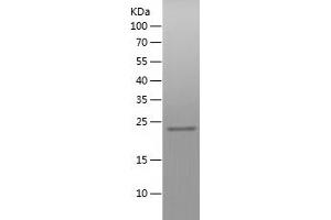 Western Blotting (WB) image for Zinc Finger CCCH-Type, Antiviral 1 (ZC3HAV1) (AA 190-377) protein (His tag) (ABIN7125771)