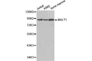 Western blot analysis of extracts of various cell lines, using MALT1 antibody. (MALT1 anticorps  (AA 125-450))