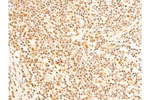 ABIN6267237 at 1/100 staining human appendiceal tissue sections by IHC-P. (FOXO3 anticorps  (pSer253))