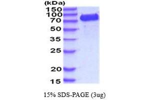 SDS-PAGE (SDS) image for Vascular Cell Adhesion Molecule 1 (VCAM1) (AA 25-698) (Active) protein (His tag) (ABIN5854444)