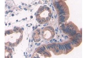 Detection of PTCH1 in Mouse Uterus Tissue using Polyclonal Antibody to Patched Homolog 1 (PTCH1)