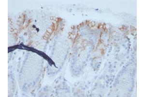 Formalin-fixed, paraffin-embedded human stomach stained with MUC2 Recombinant Mouse Monoclonal Antibody (rMLP/842).