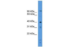 WB Suggested Anti-PRSS23 Antibody Titration: 0. (PRSS23 anticorps  (C-Term))