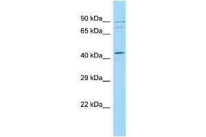 Host: Rabbit Target Name: ZER1 Sample Type: Fetal Kidney lysates Antibody Dilution: 1. (ZER1 anticorps  (C-Term))