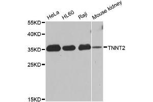 Western blot analysis of extracts of various cell lines, using TNNT2 antibody (ABIN5970474) at 1/1000 dilution. (Cardiac Troponin T2 anticorps)