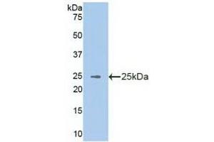 Detection of Recombinant VAV3, Human using Polyclonal Antibody to Vav 3 Oncogene (VAV3) (VAV3 anticorps  (AA 398-583))