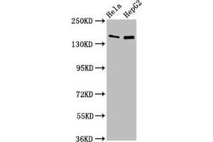 Western Blot Positive WB detected in: Hela whole cell lysate, HepG2 whole cell lysate All lanes: SULF1 antibody at 4 μg/mL Secondary Goat polyclonal to rabbit IgG at 1/50000 dilution Predicted band size: 102 kDa Observed band size: 150 kDa (SULF1 anticorps  (AA 105-372))