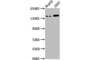 Western Blot Positive WB detected in: HepG2 whole cell lysate, 293T whole cell lysate All lanes: SMC5 antibody at 4. (SMC5 anticorps  (AA 296-403))