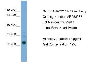 WB Suggested Anti-TP53INP2  Antibody Titration: 0. (TP53INP2 anticorps  (C-Term))