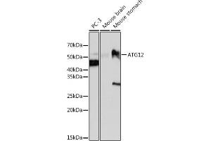 Western blot analysis of extracts of various cell lines, using  antibody (ABIN7265788) at 1:1000 dilution. (ATG12 anticorps)