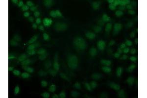 Image no. 2 for anti-Cyclin-Dependent Kinase 2 (CDK2) antibody (ABIN1497398)