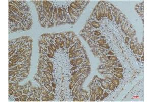 Immunohistochemistry (IHC) analysis of paraffin-embedded Mouse ColonTissue using AMPK a1 Mouse Monoclonal Antibody diluted at 1:200. (PRKAA1 anticorps)