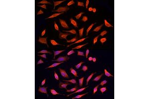 Immunofluorescence analysis of HeLa cells using STK24 Rabbit pAb (ABIN6132364, ABIN6148602, ABIN6148603 and ABIN6214875) at dilution of 1:250 (40x lens).