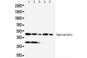 Anti-Haptoglobin antibody, Western blotting Lane 1:RAJI Cell Lysate Lane 2:HL-60 Cell Lysate Lane 3:HUT102 Cell Lysate Lane 4:JURKAT Cell Lysate Lane 5:CEM Cell Lysate