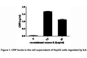 Interleukin-6 (IL-6), a pro-inflammatory cytokine and an anti-inflammatory myokine, plays important roles in the acute phase reaction, inflammation, hematopoiesis, bone metabolism, and cancer progression.